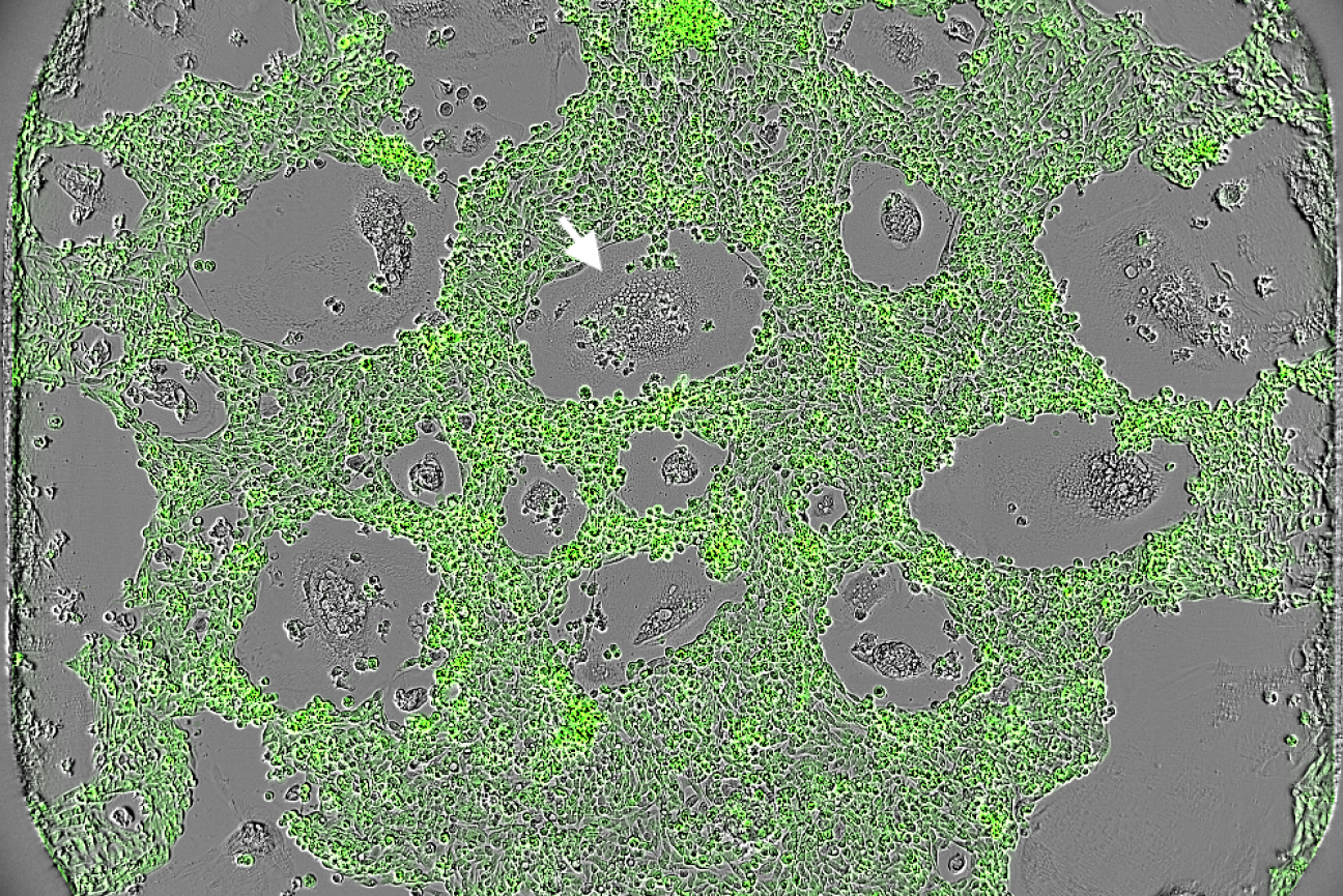 A surface of cells with grey spots inside of a larger green area, and one white arrow pointing at a grey spot